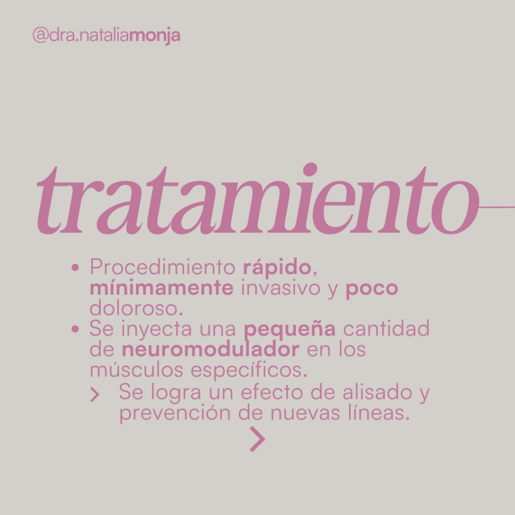 infografía con la explicación sobre el tratamiento con neuromoduladores.