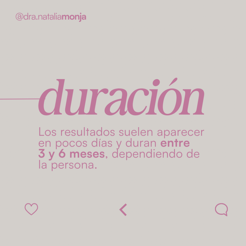 infografía con la explicación de la duración del tratamiento con neuromoduladores.