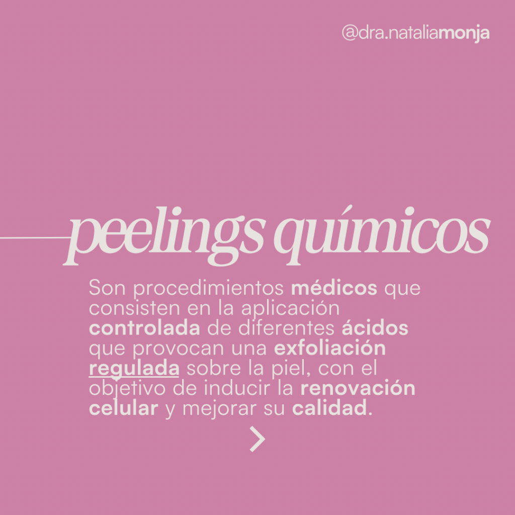 infografía con descripción de peelings químicos