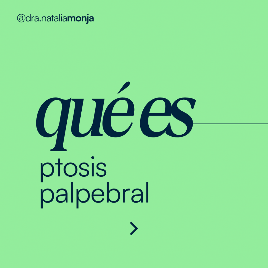 infografia con "qué es ptosis palpebral"