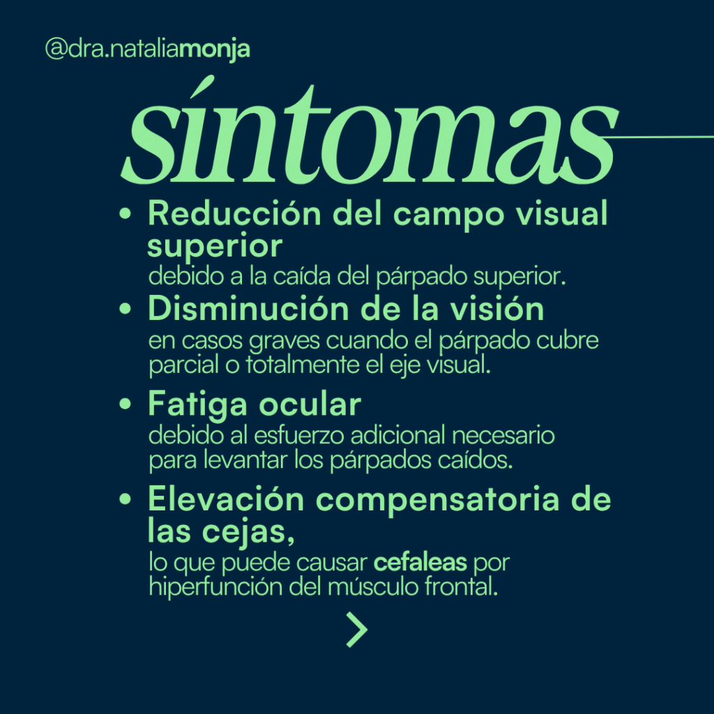 infografia con los síntomas de la ptosis palpebral