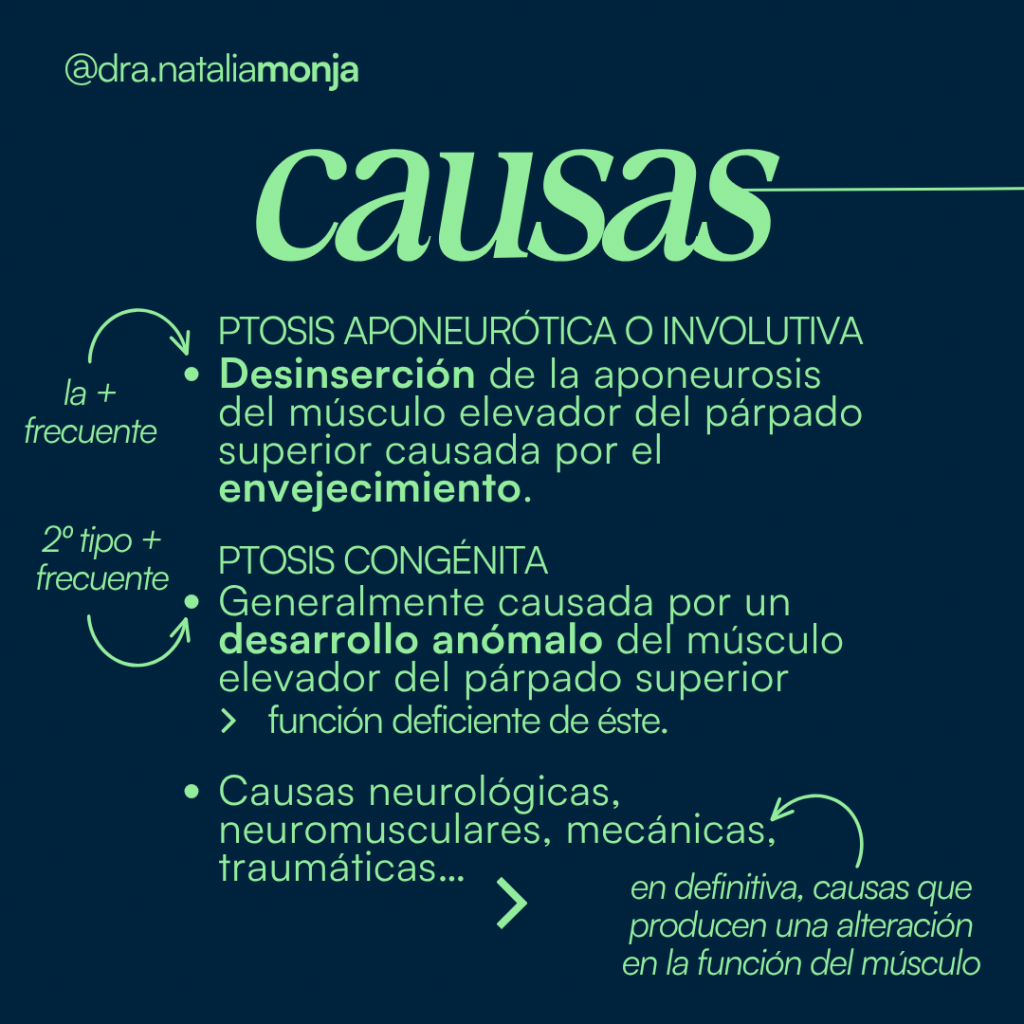 infografia con las causas de la ptosis palpebral